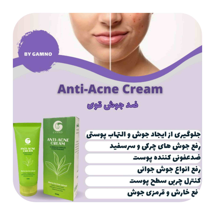 کرم آنتی آکنه گامنو